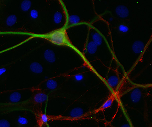 GAP43, Polyclonal Guinea pig antiserum
