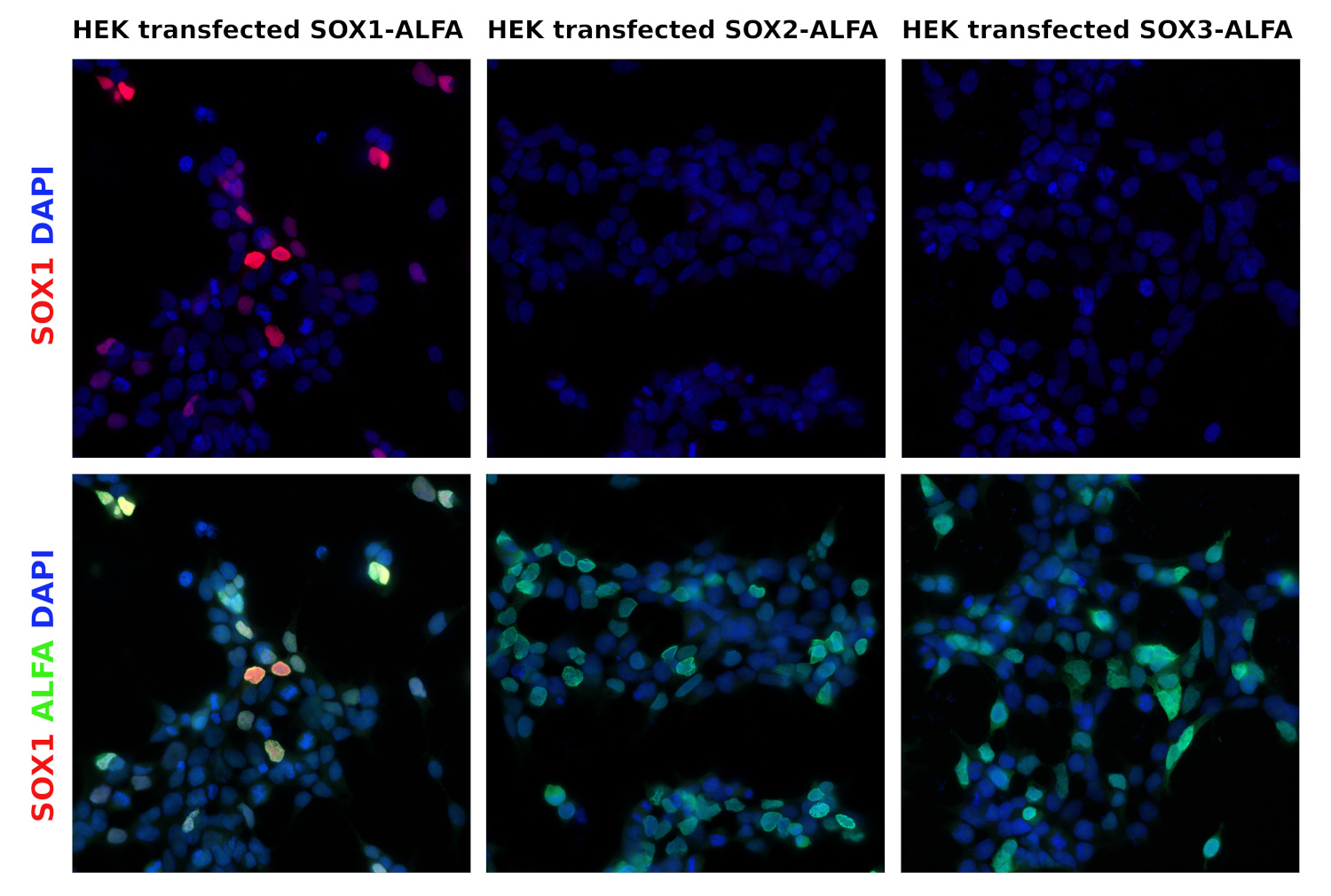SOX1, Polyclonal Guinea pig antiserum