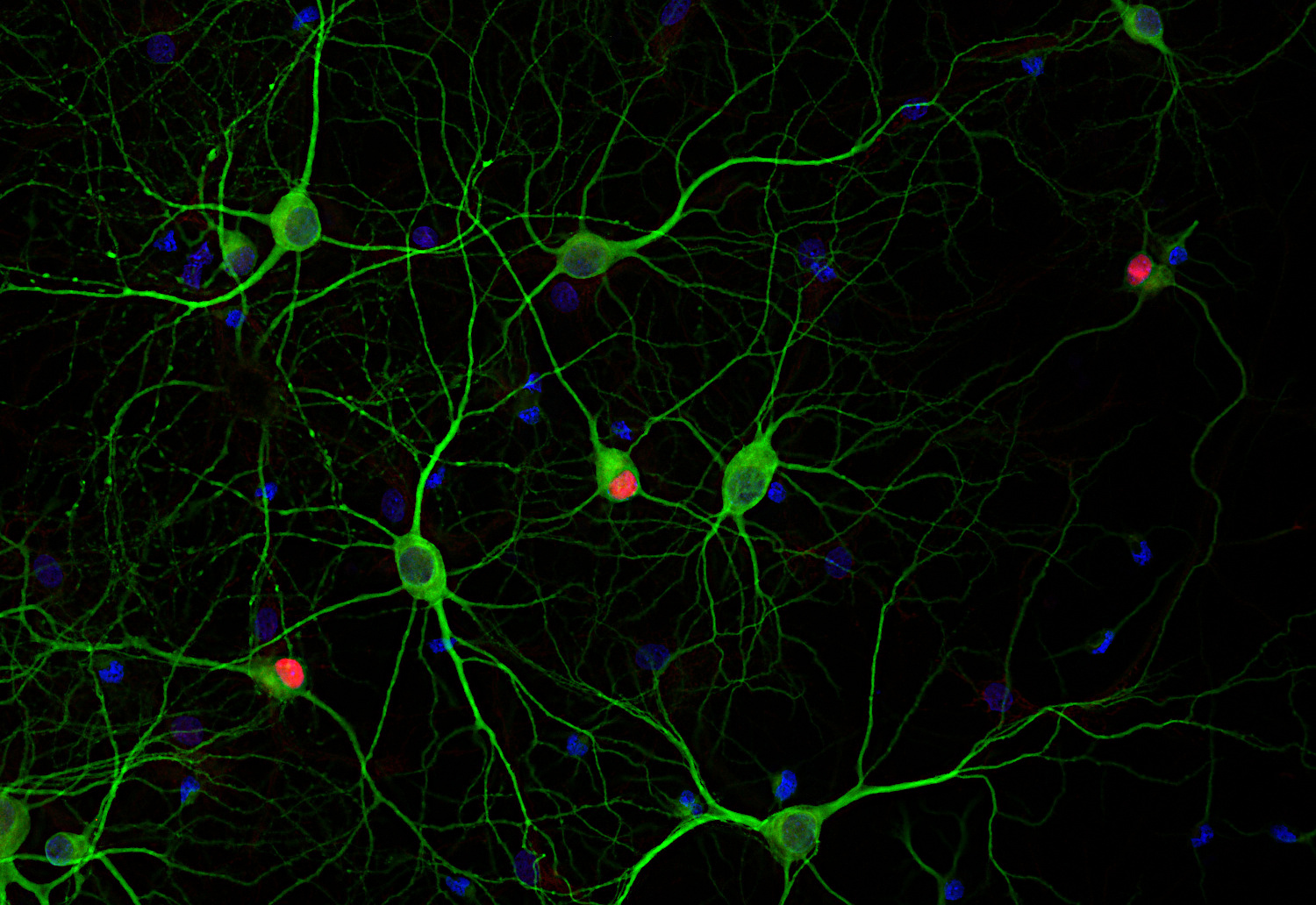 SOX1, Polyclonal Guinea pig antiserum