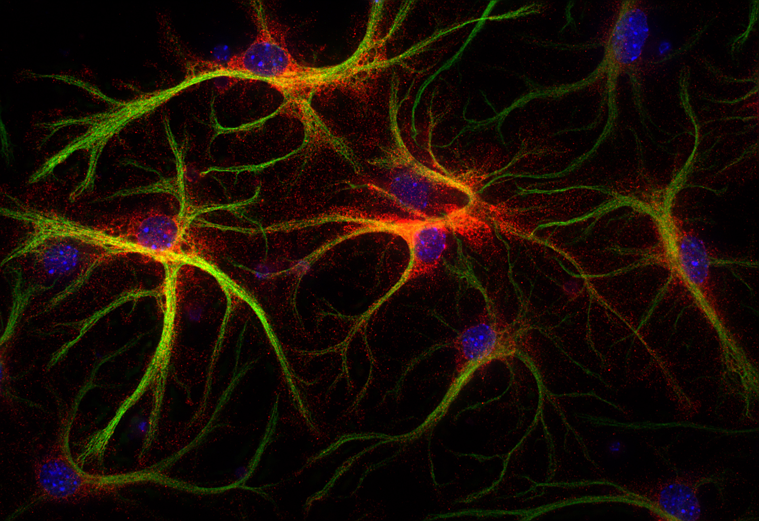 Glutamine synthetase Recombinant rabbit - image 3