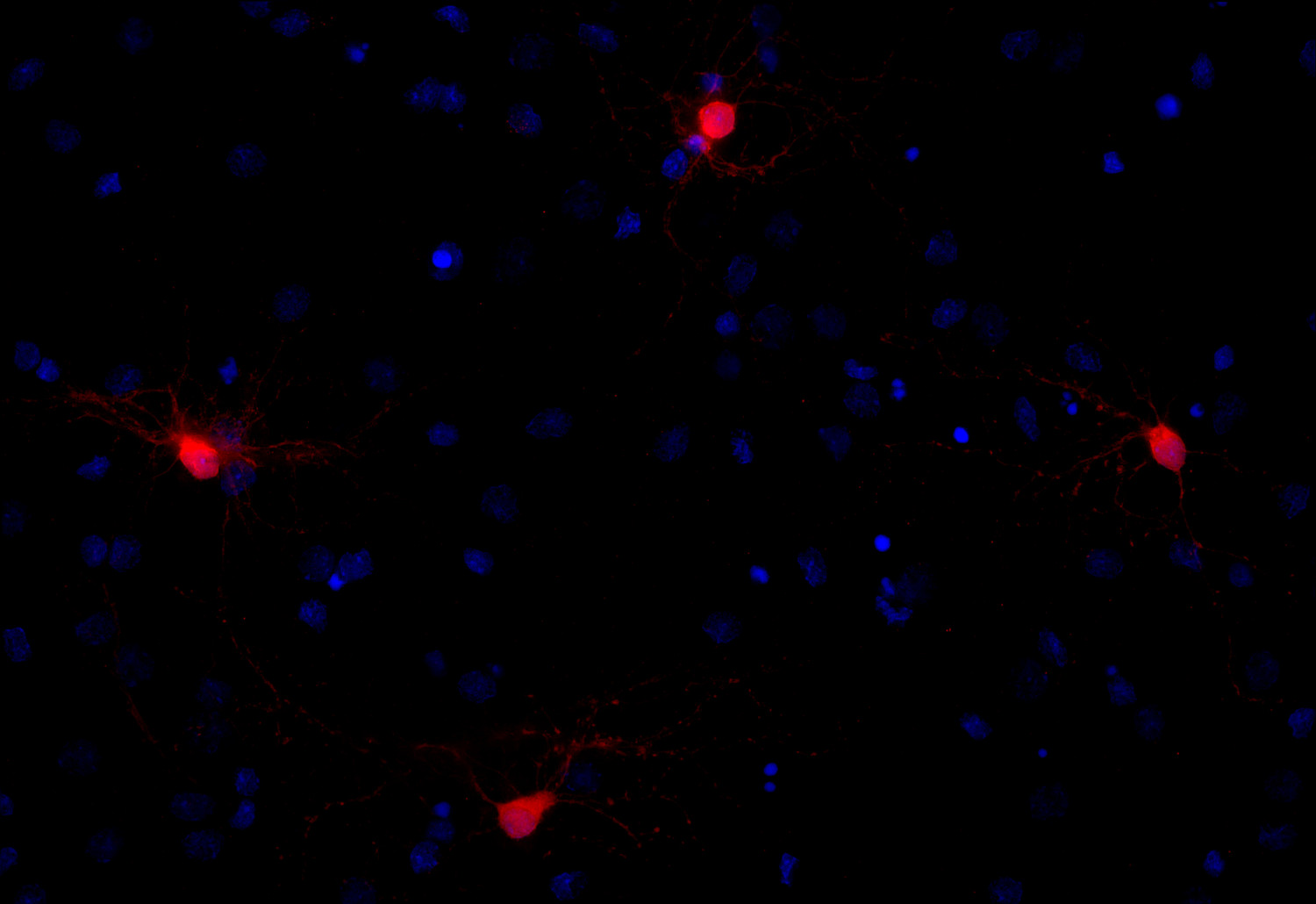 DARPP32, Polyclonal rabbit antiserum