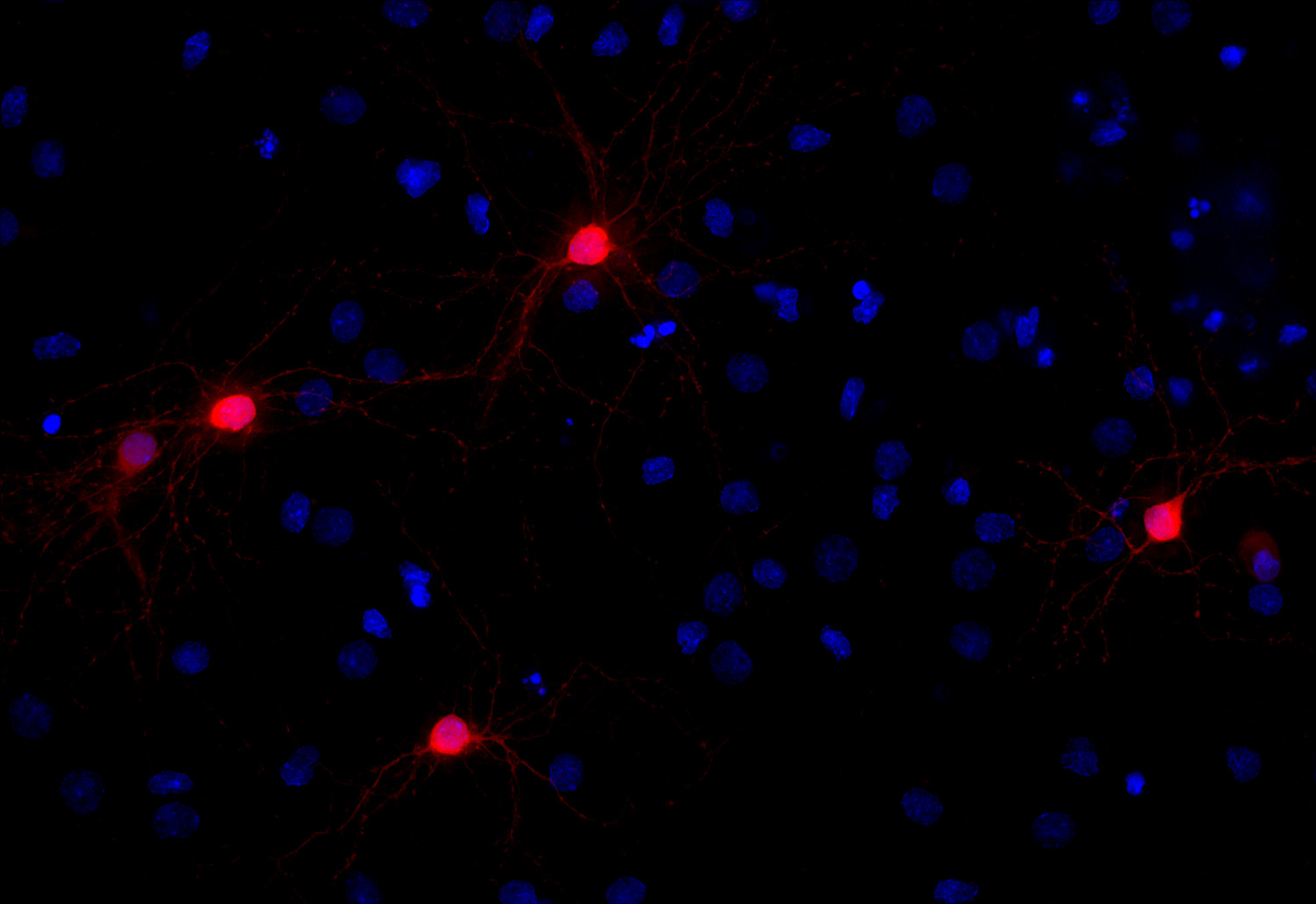 DARPP32, Polyclonal Guinea pig antiserum
