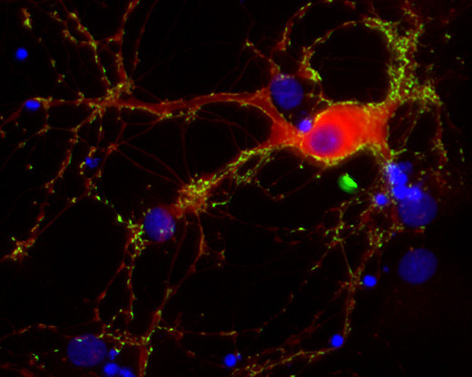 Calcineurin A Polyclonal rabbit antiserum - image 2