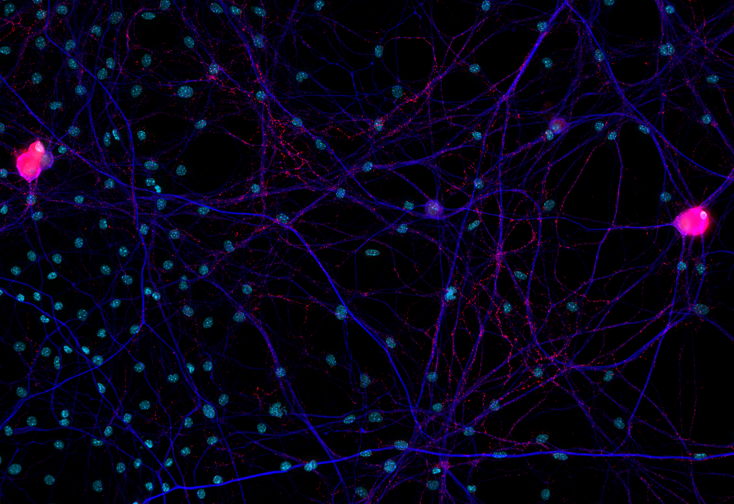 CGRP, Polyclonal Guinea pig antiserum