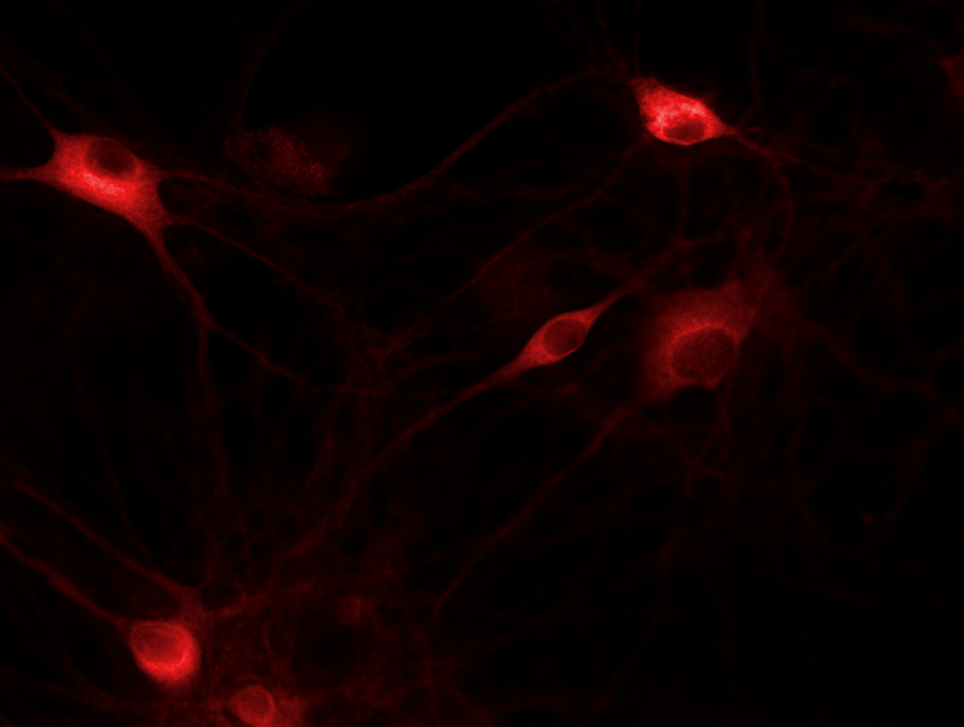CPT1c Polyclonal rabbit purified antibody - image 3