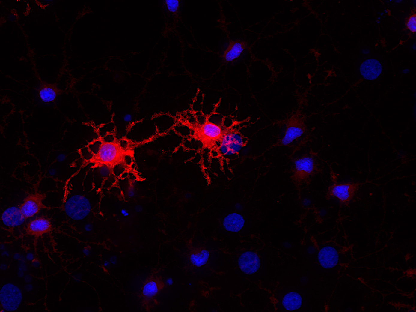 BCAS1 Polyclonal Guinea pig antiserum - image 2