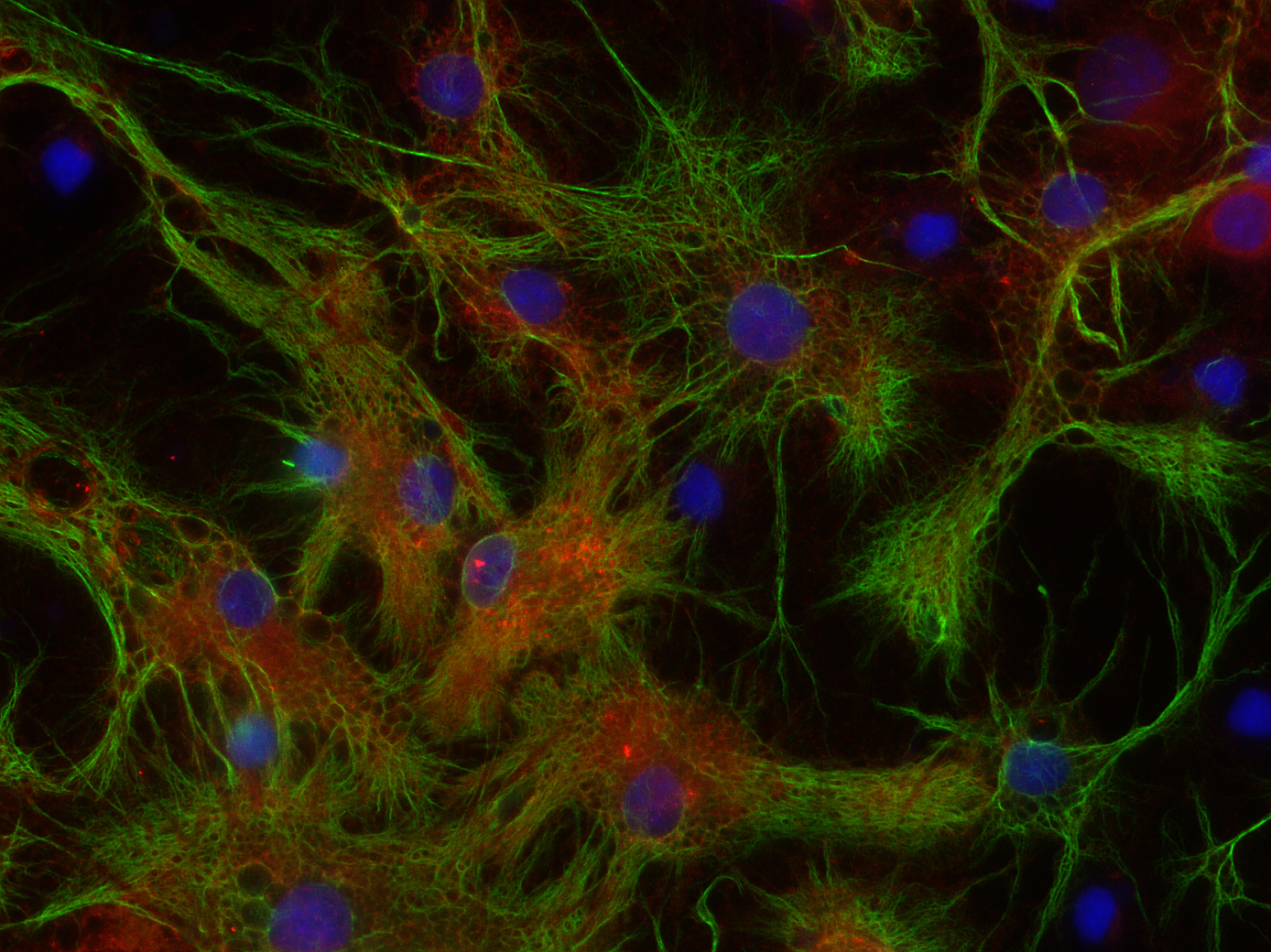 Aldolase C Polyclonal Guinea pig antiserum - image 3