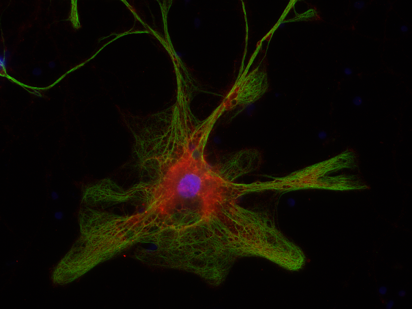 Aldolase C Polyclonal Guinea pig antiserum - image 4