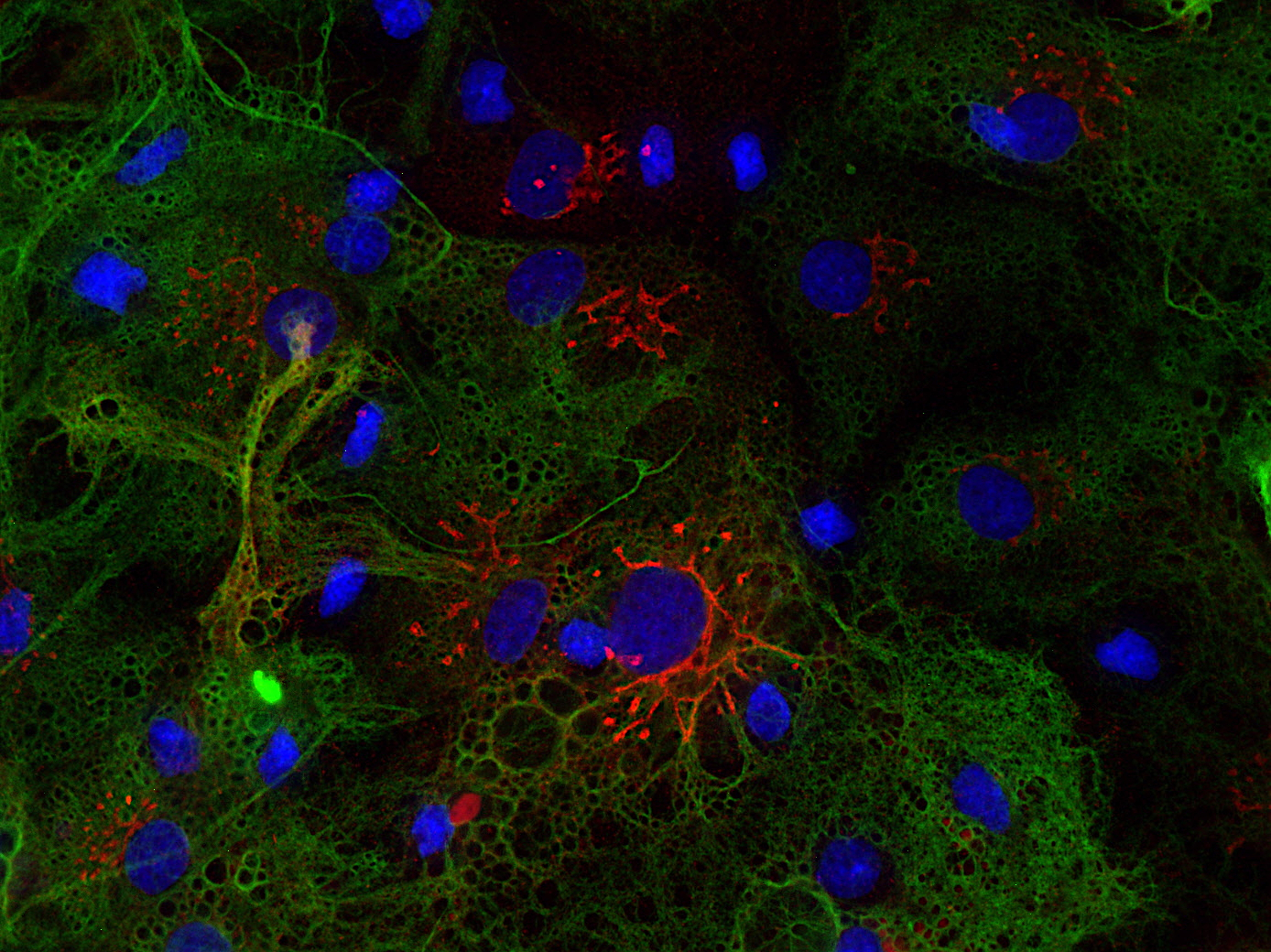 ApoE, Polyclonal Guinea pig antiserum