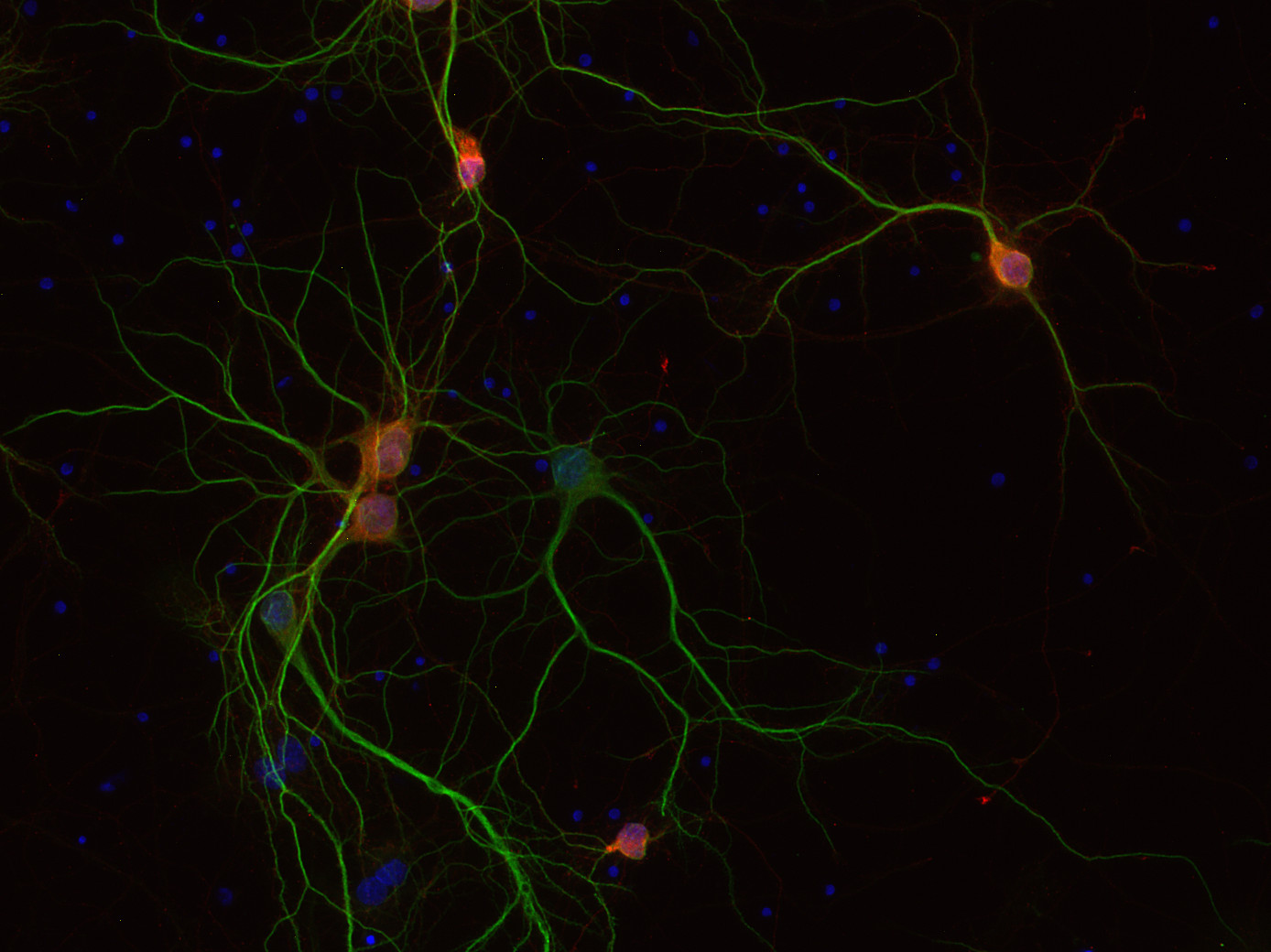 PCP4, Polyclonal Guinea pig antiserum