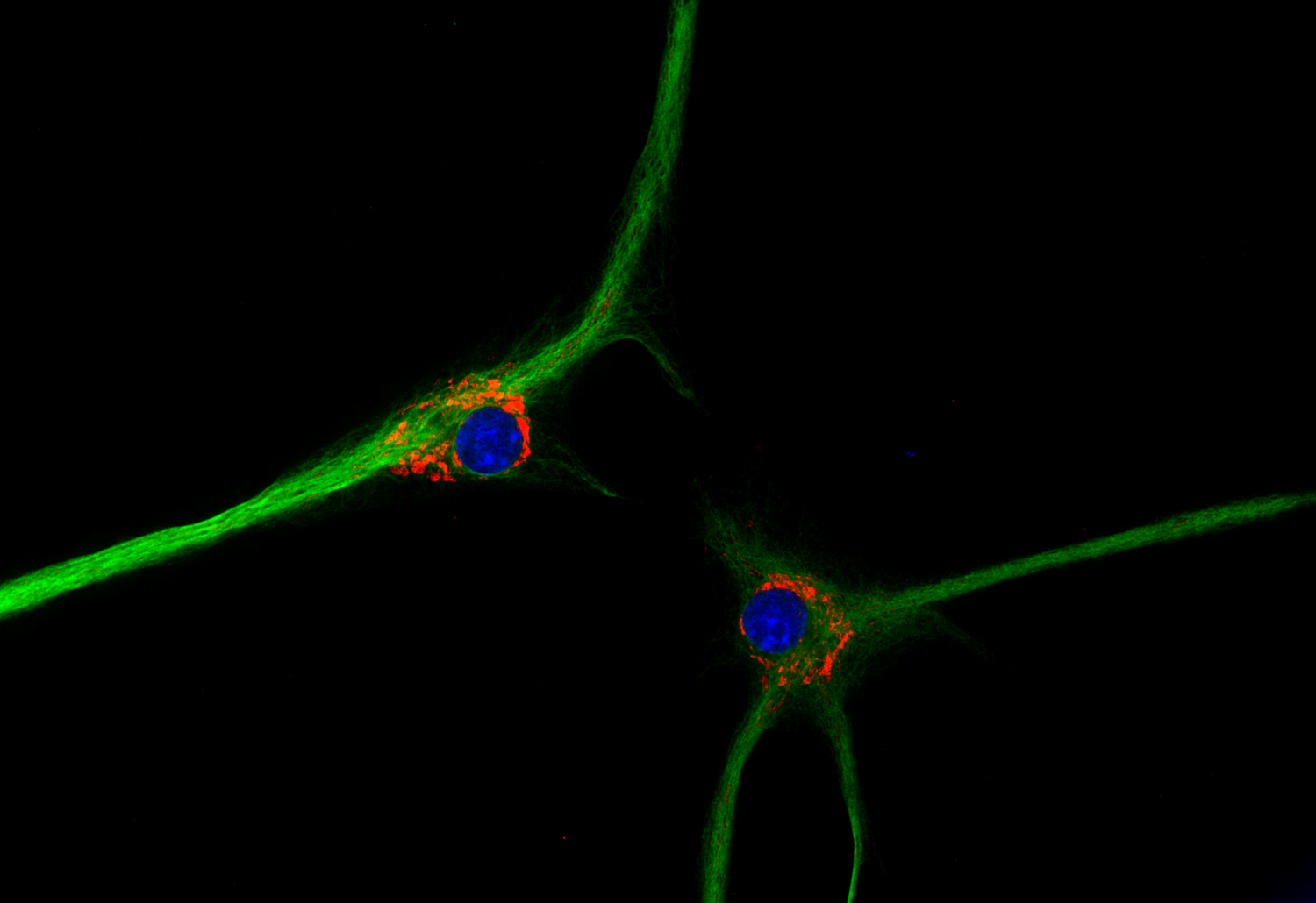 Glutamate dehydrogenase Polyclonal Guinea pig antiserum - image 2