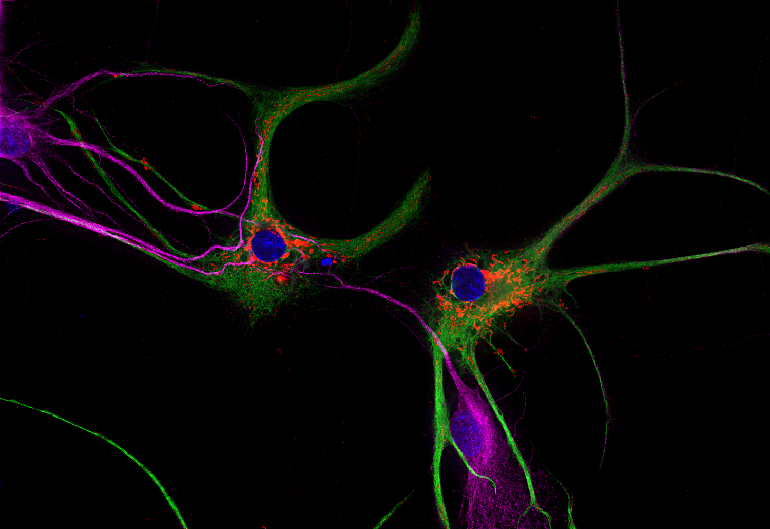 Glutamate dehydrogenase Polyclonal Guinea pig antiserum - image 3
