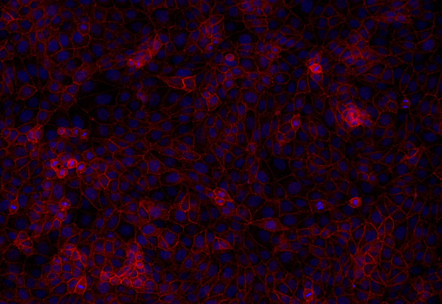 JAM-A, Polyclonal Guinea pig antiserum