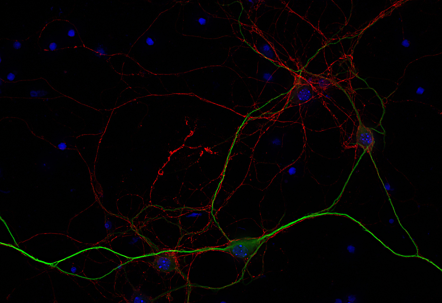L1CAM, Recombinant rabbit