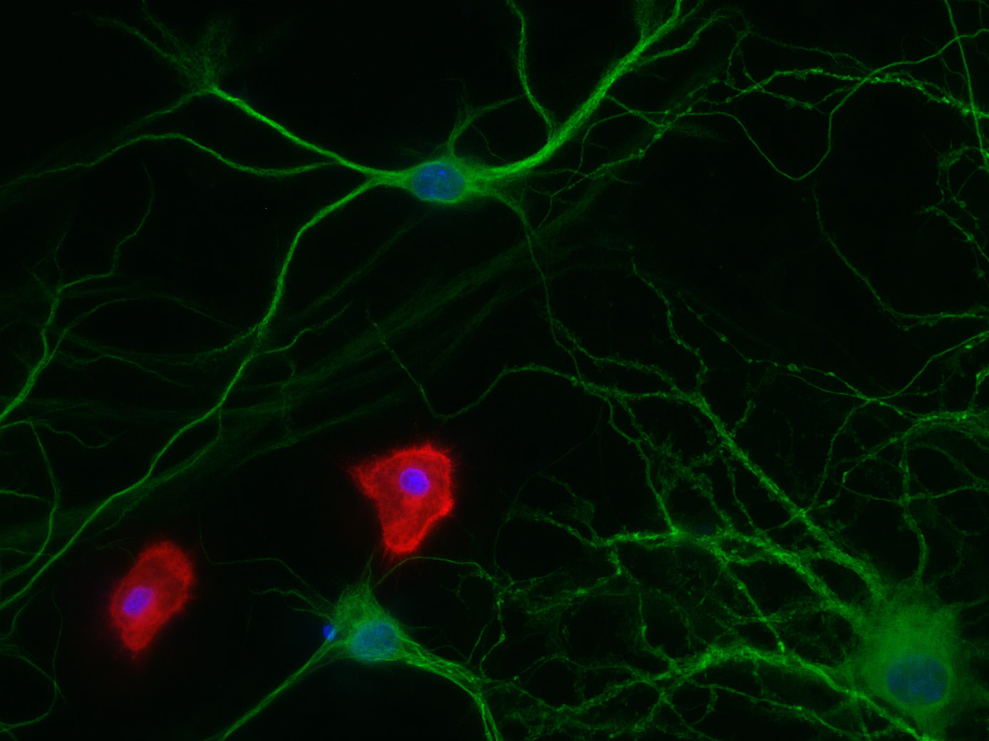 IBA1 Recombinant rabbit - image 2
