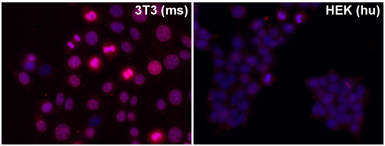 Ki67 Polyclonal rabbit antiserum - image 1