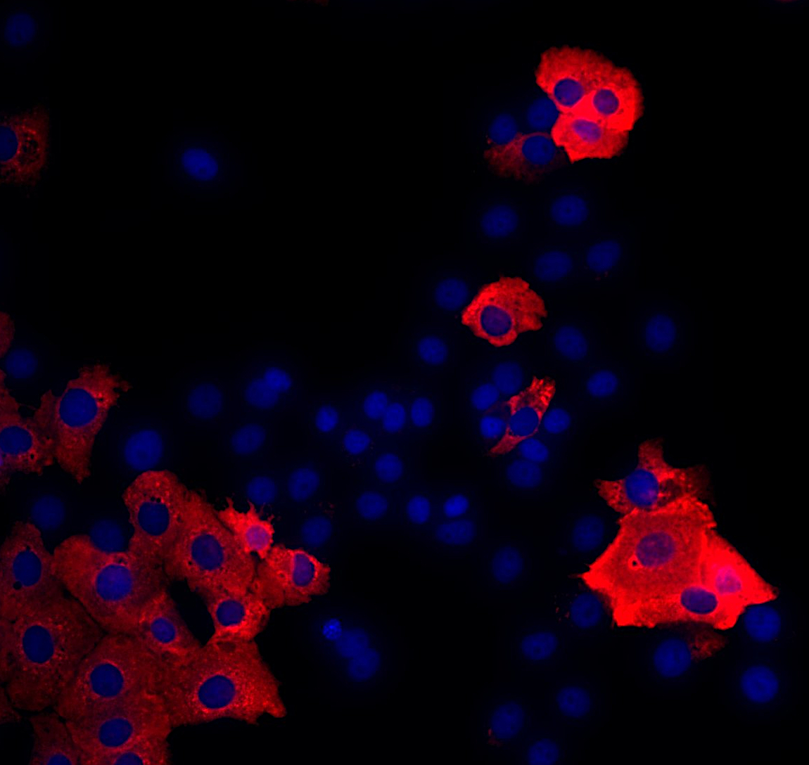 Nucleocapsid CoV-2 Monoclonal mouse purified IgG - image 2