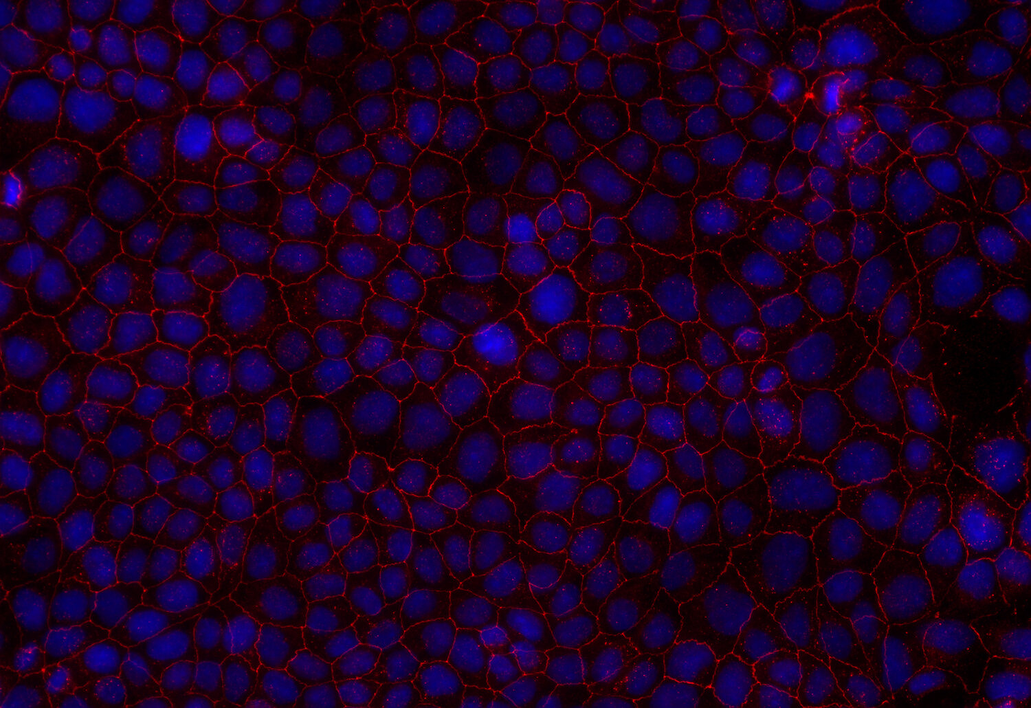 Synaptic Systems - Claudin5