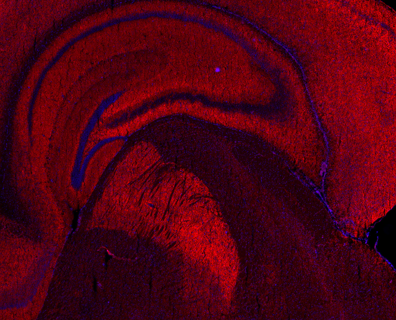 Shank3 Polyclonal rabbit antiserum - image 5