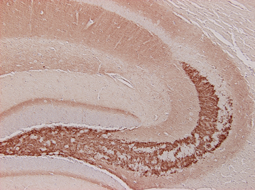 Synaptoporin Polyclonal rabbit antiserum - image 4