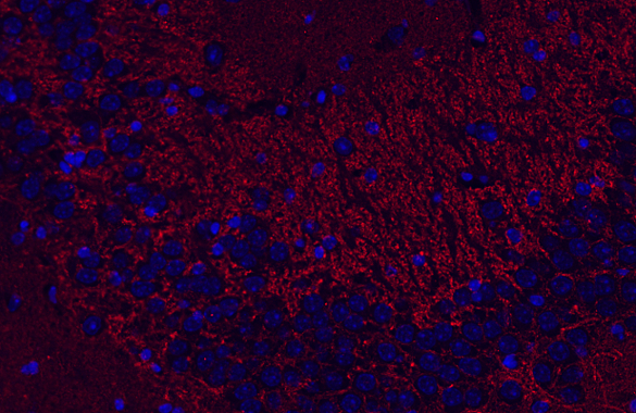 Synaptogyrin3 Polyclonal rabbit antiserum - image 4