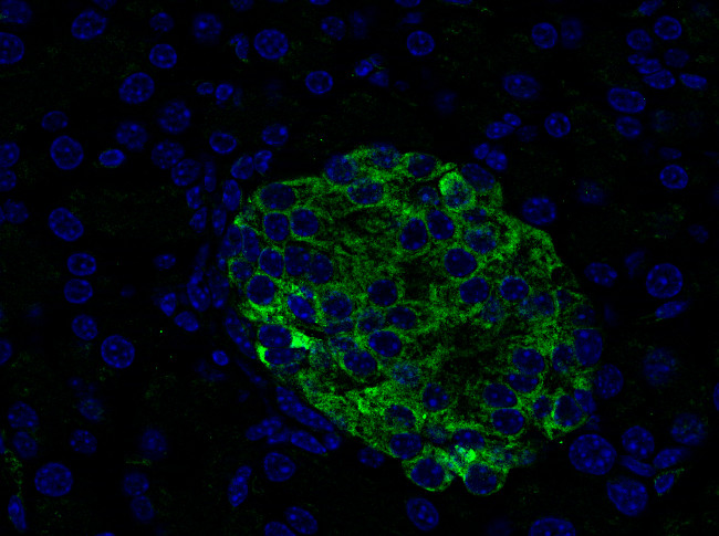 VAMP1/2/3 Polyclonal Guinea pig antiserum - image 5