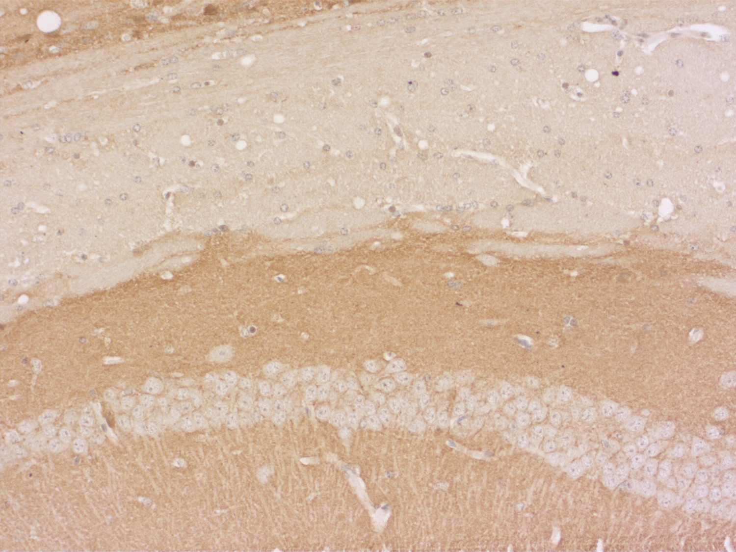 Synaptotagmin1/2 Polyclonal rabbit antiserum - image 4