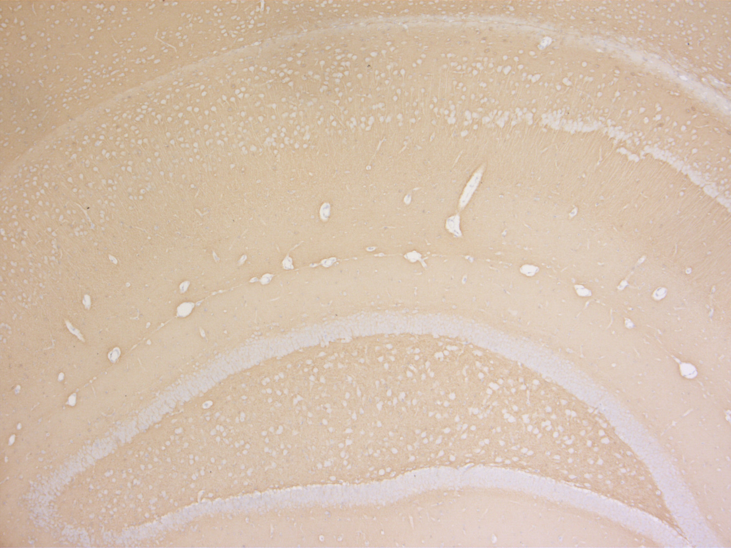 Synapsin1/2 Polyclonal Guinea pig antiserum - image 5
