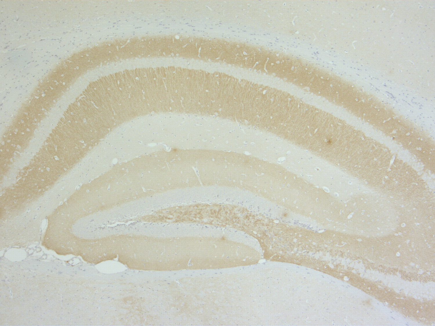 Synapsin2 Monoclonal mouse purified IgG - image 4