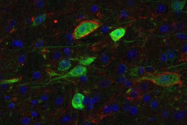 Proton ATPase Polyclonal rabbit antiserum - image 3