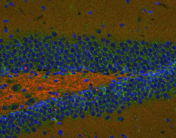 Syntaxin11 Polyclonal rabbit purified antibody - image 4