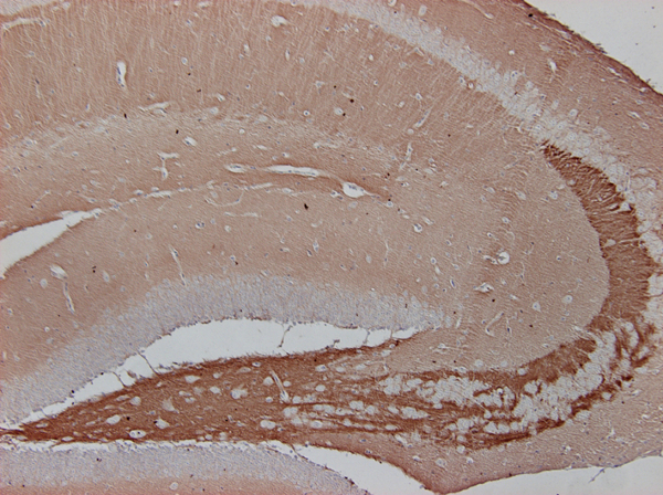 Syntaxin1B Polyclonal rabbit antiserum - image 4