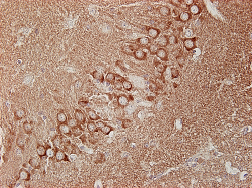 Dynamin1/2/3 Polyclonal rabbit antiserum - image 4