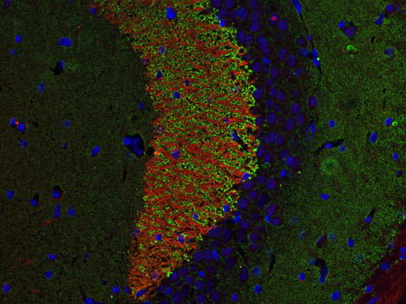 Munc18-1 Polyclonal rabbit antiserum - image 4