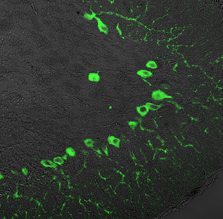 IP3-receptor type1 Polyclonal rabbit antiserum - image 2