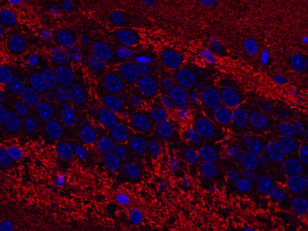 SV2 A Polyclonal rabbit antiserum - image 4