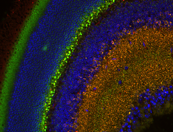 Complexin4 Polyclonal rabbit antiserum - image 3