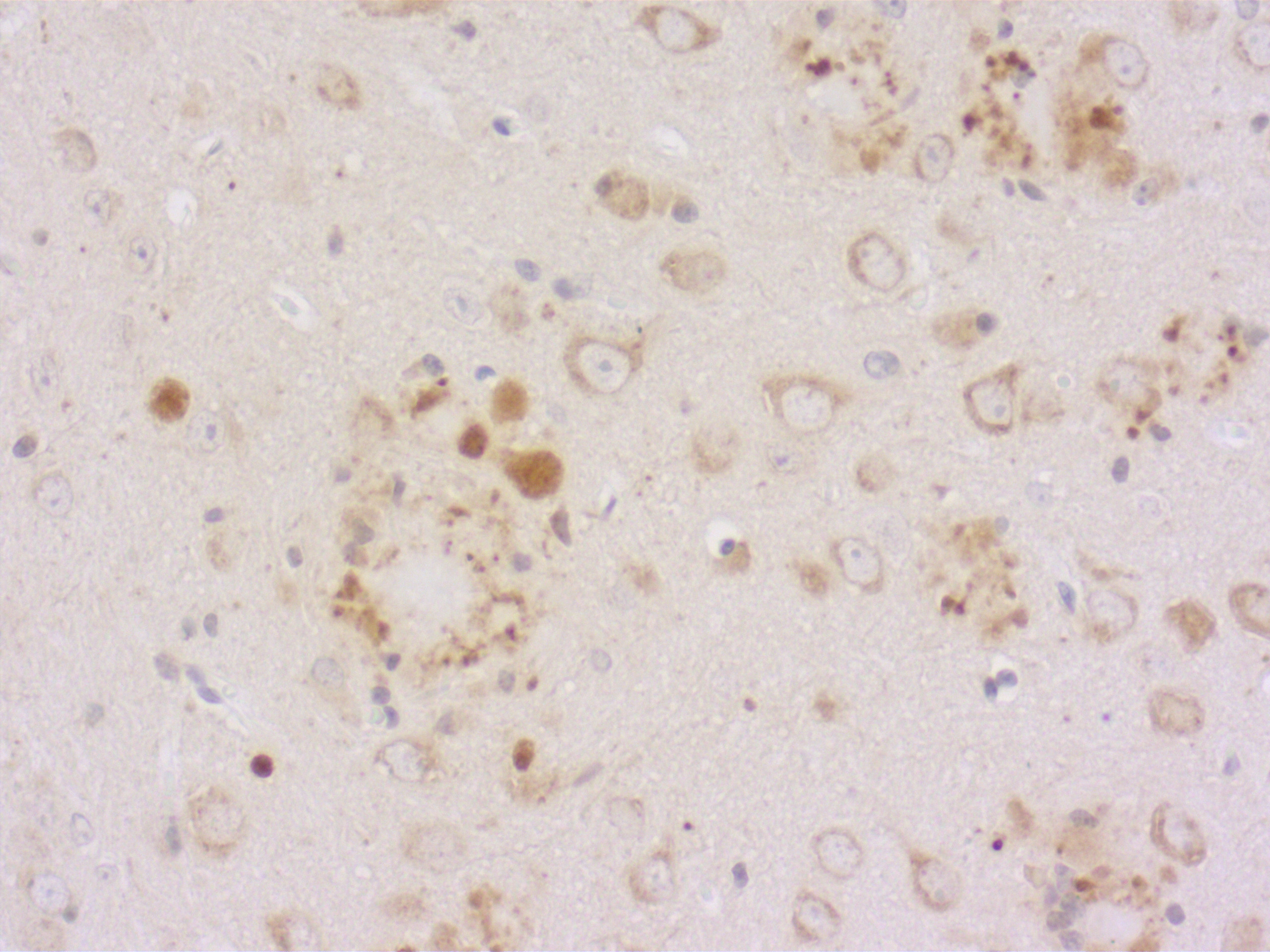 APP, Polyclonal rabbit antiserum