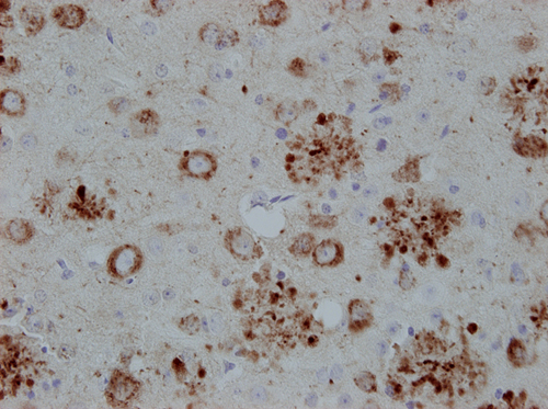 APP Polyclonal rabbit purified antibody - image 5