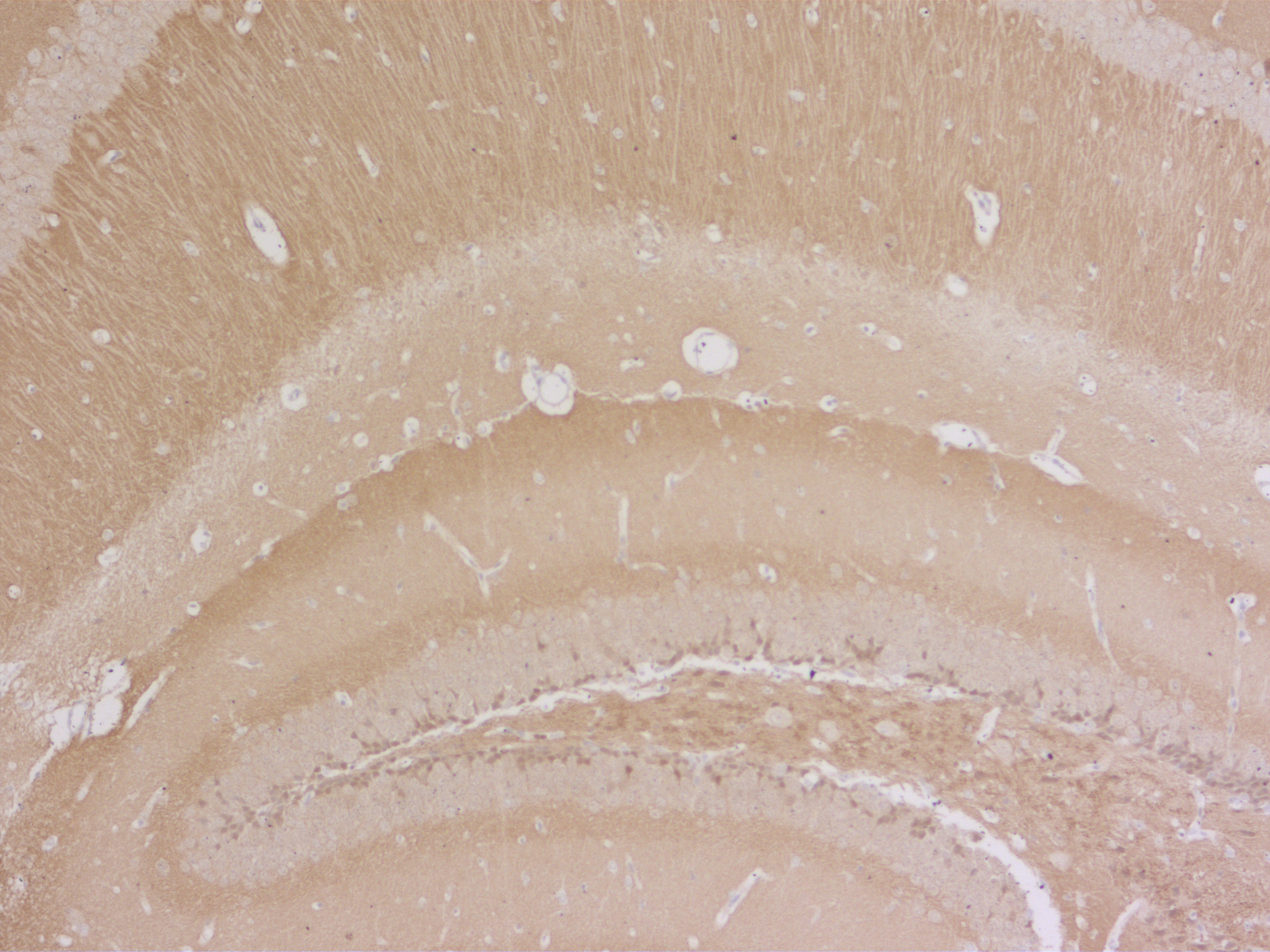 alpha/beta Synuclein Polyclonal rabbit antiserum - image 4