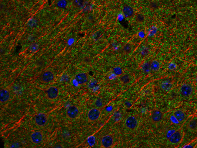 alpha/beta Synuclein Polyclonal rabbit purified antibody - image 4