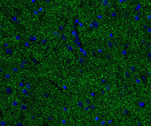 alpha/beta Synuclein Monoclonal mouse purified IgG - image 3