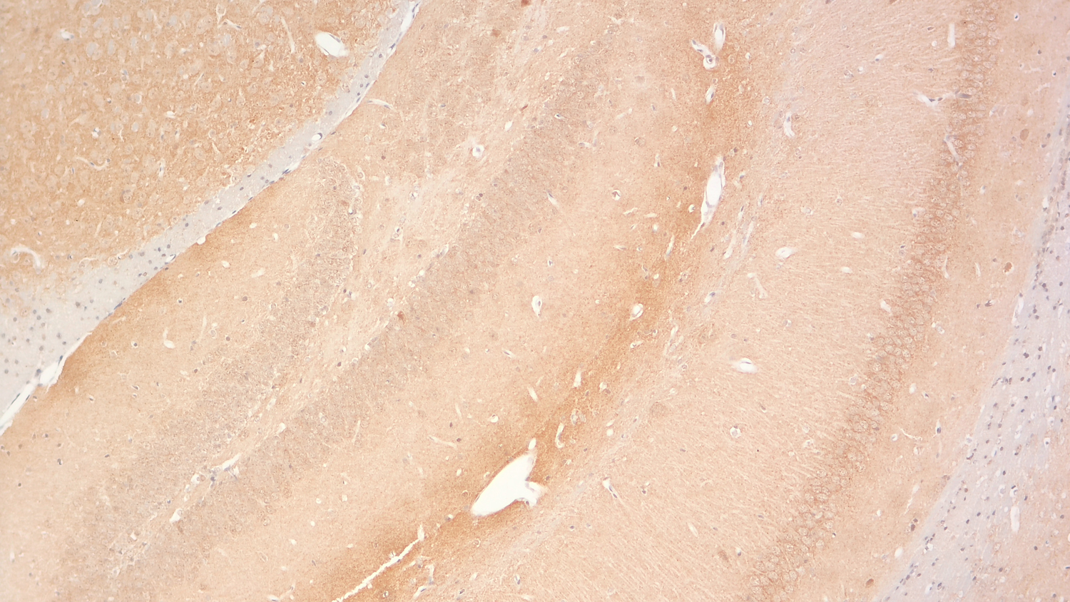 Neuroligin2 Recombinant Guinea pig - image 5