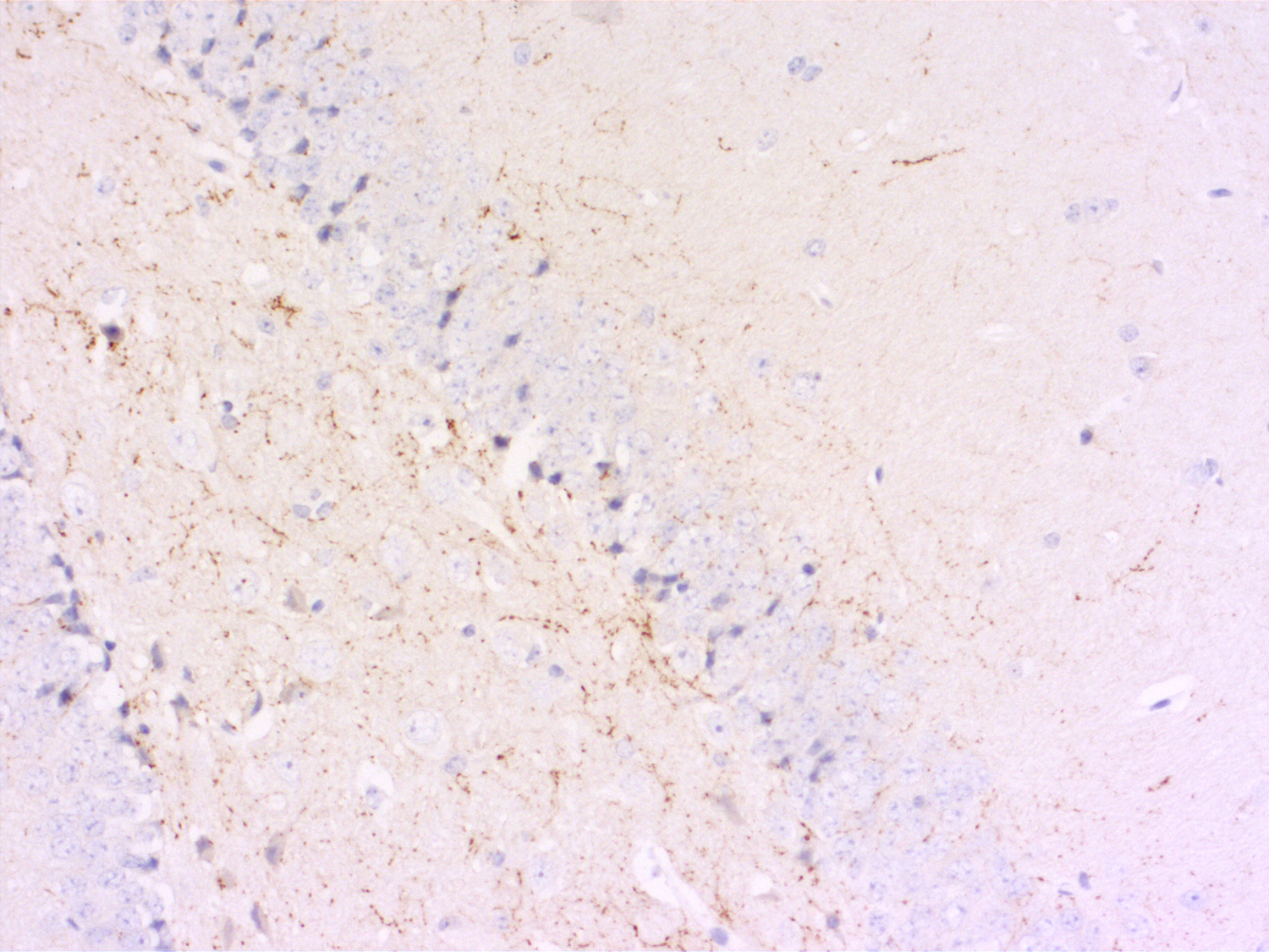 VGLUT3 Recombinant rabbit - image 5