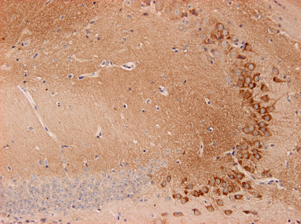 Endophilin1, Polyclonal rabbit antiserum
