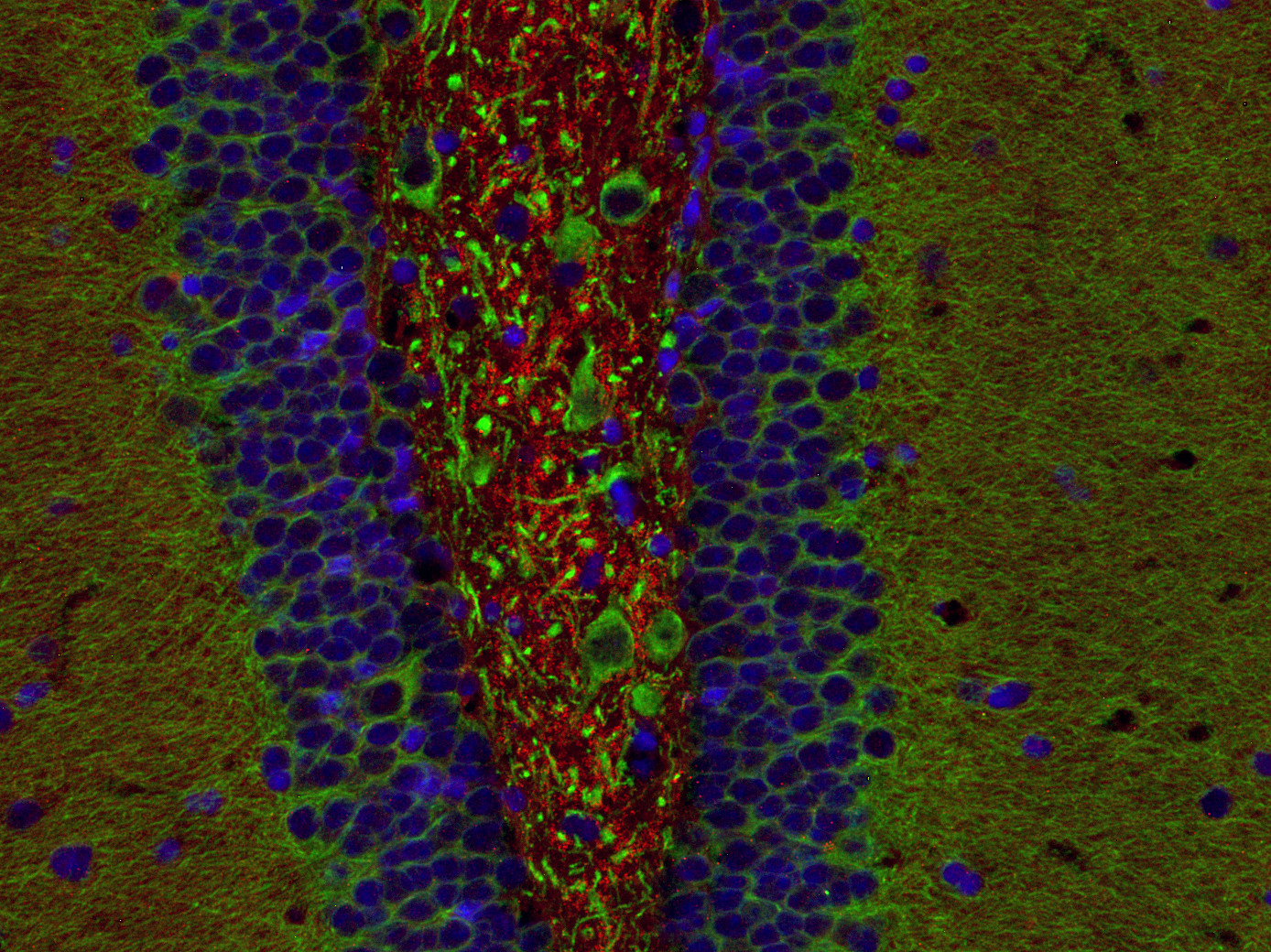 Homer1b/c, Polyclonal Guinea pig purified antibody