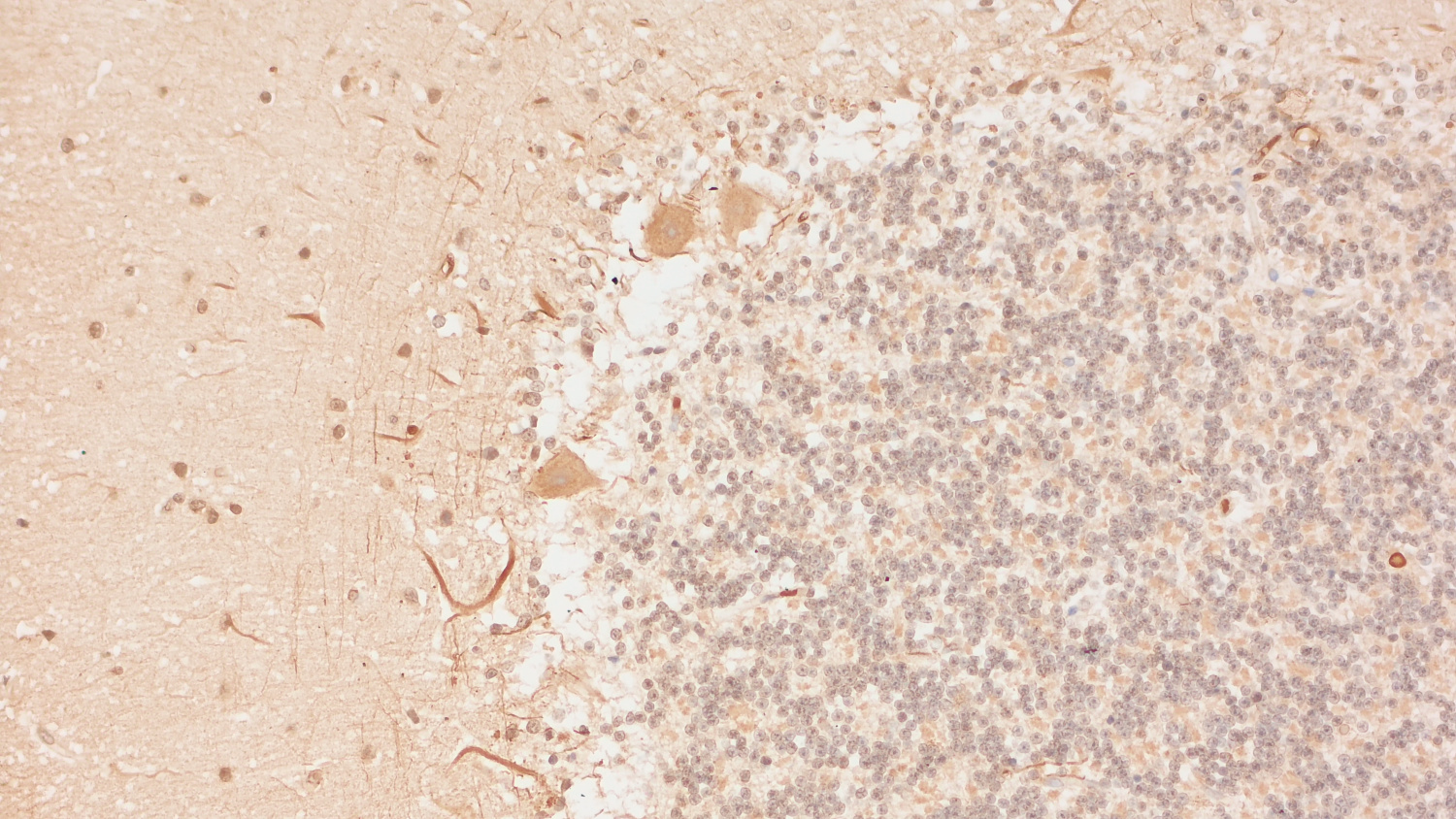 alpha-Internexin, Polyclonal rabbit antiserum