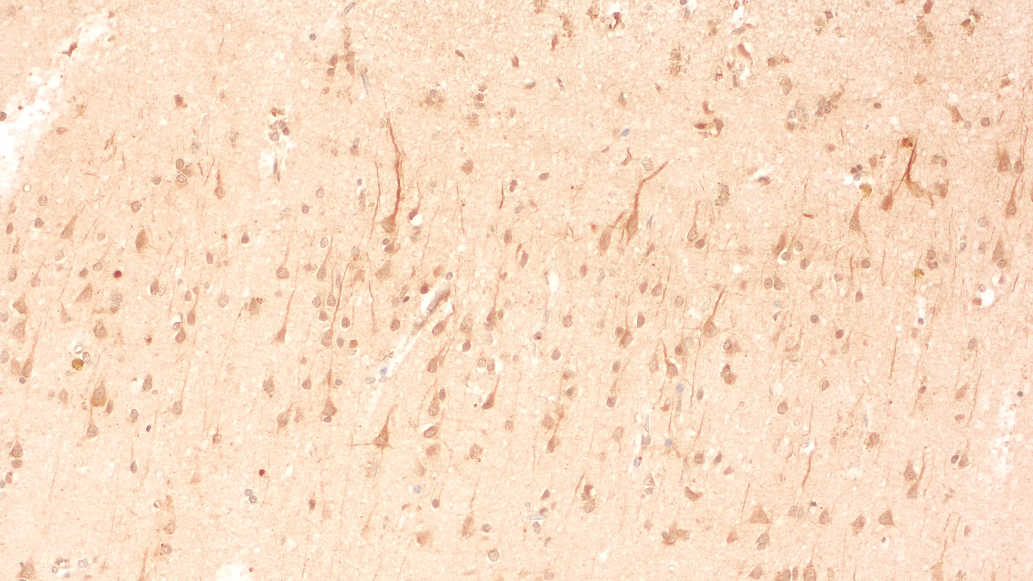 alpha-Internexin, Polyclonal rabbit antiserum