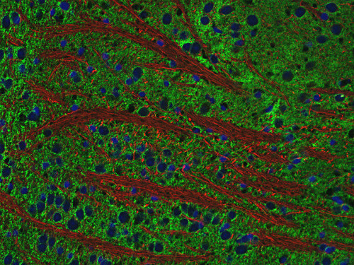 Neurofilament H Polyclonal chicken purified antibody - image 3