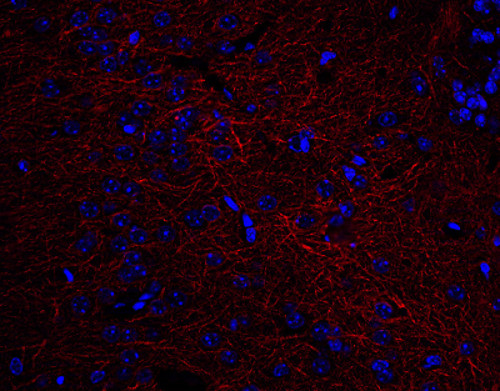 Neurofilament M Polyclonal rabbit antiserum - image 4